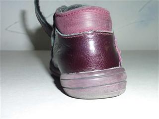 déformation valgus chaussure