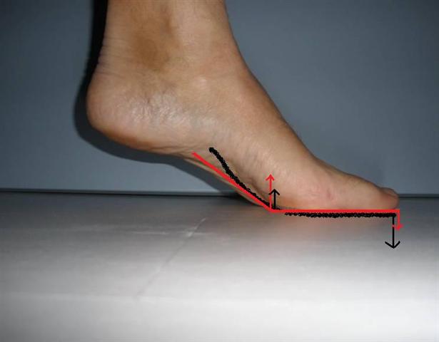 long flechisseur hallux