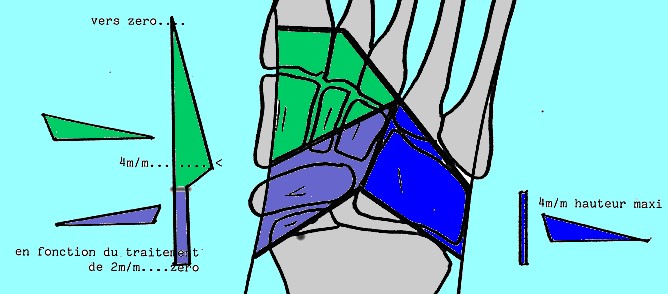 élément normalisateur postural médio pied médio tarse