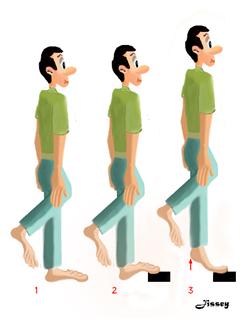 exercice d'appui unipodal traitement rééducation