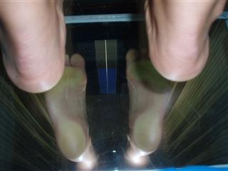 talon valgus arrière pied calcanéen