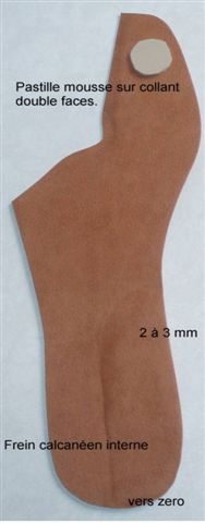 semelle hallux valgus traitement